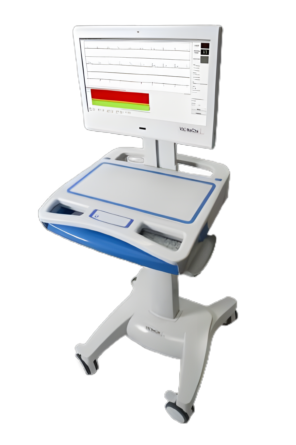 Vectraplex Battery Operated Electrocardiograph with Color Display