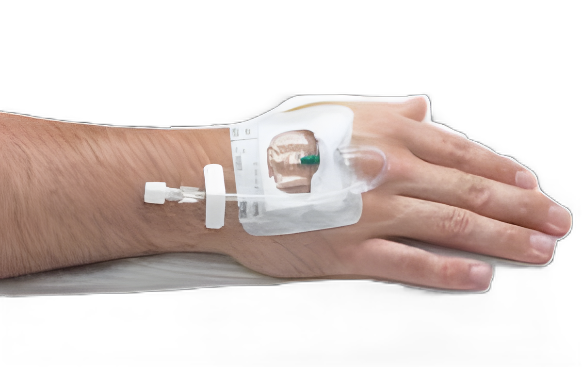 IV Start Kit - IVSSTK1
