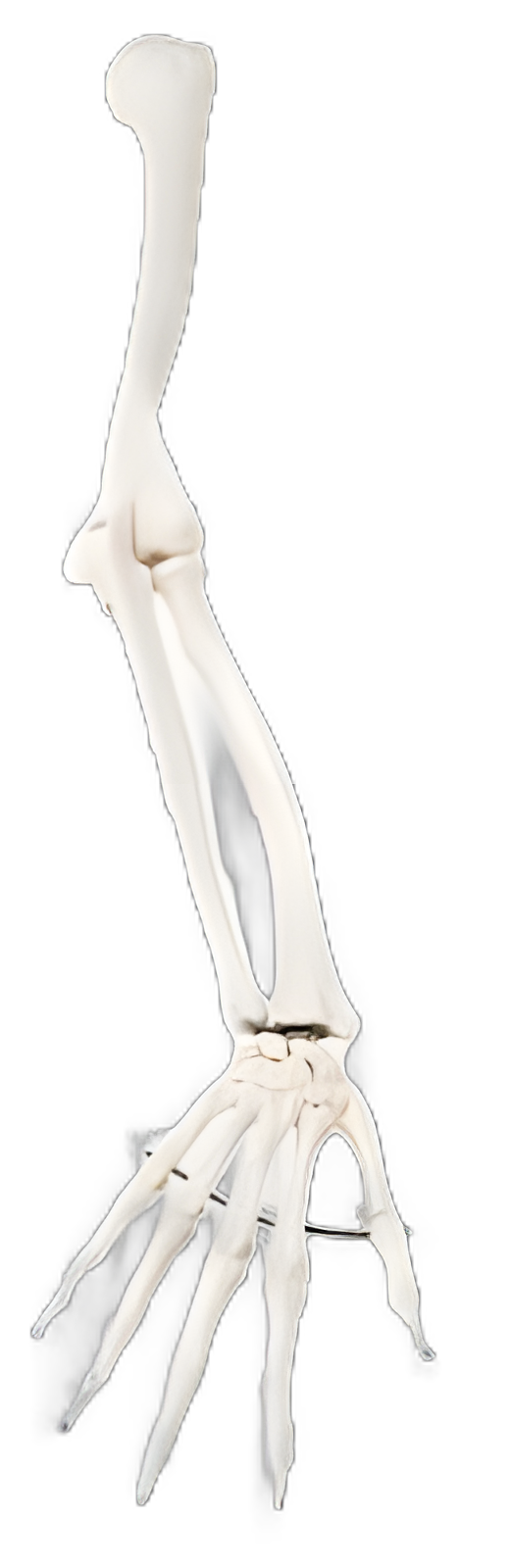 3B Scientific Right Arm Skeleton Model - Gender Neutral Adult