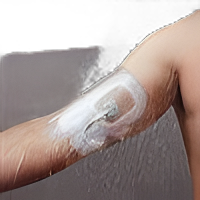 IV Site Barrier Protector ShowerGuard™ 7 X 7 Inch
