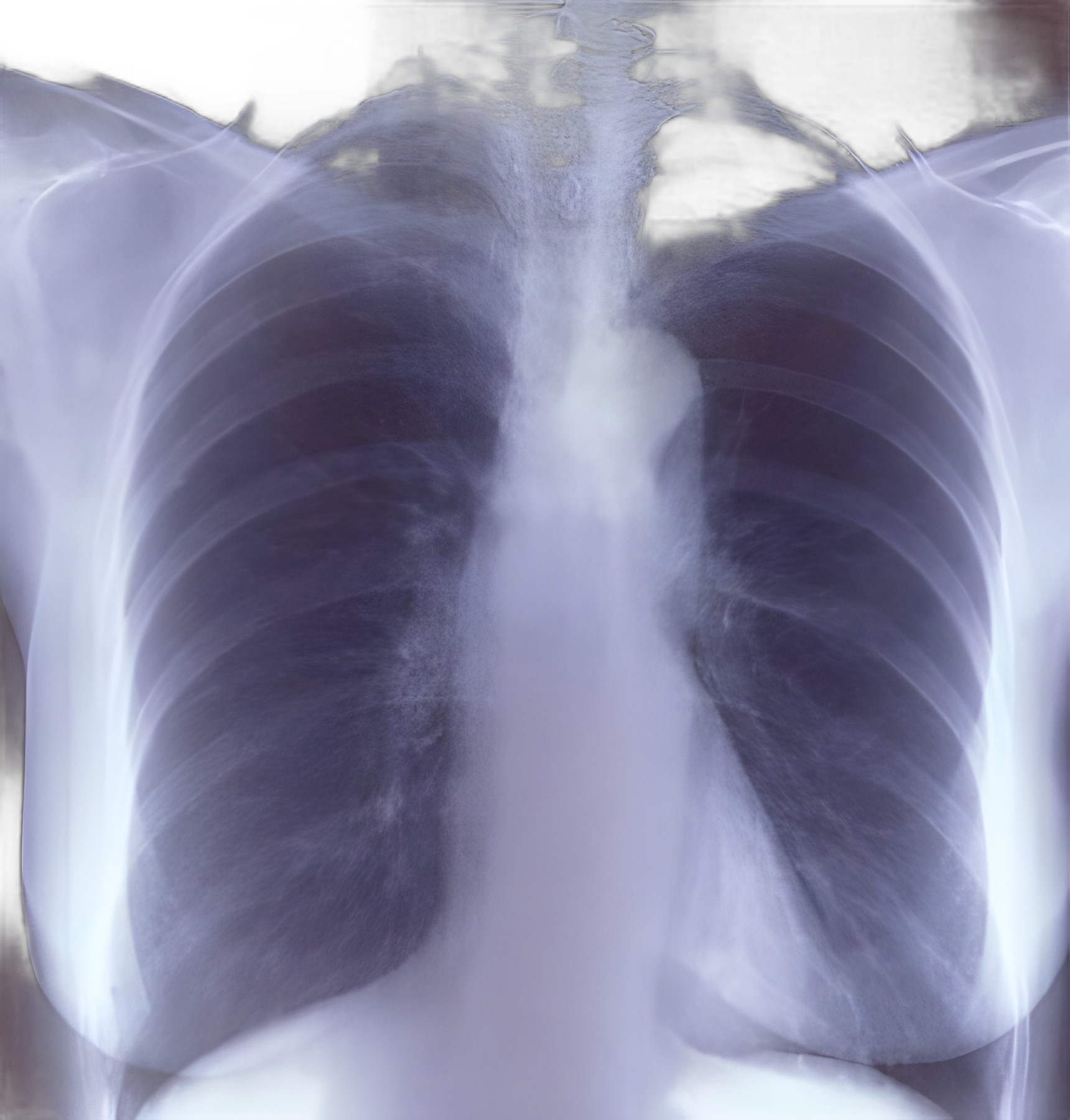 X-Ray Film Clear Choice™ Performance 8 X 10 Inch Half Speed Green Sensitive High