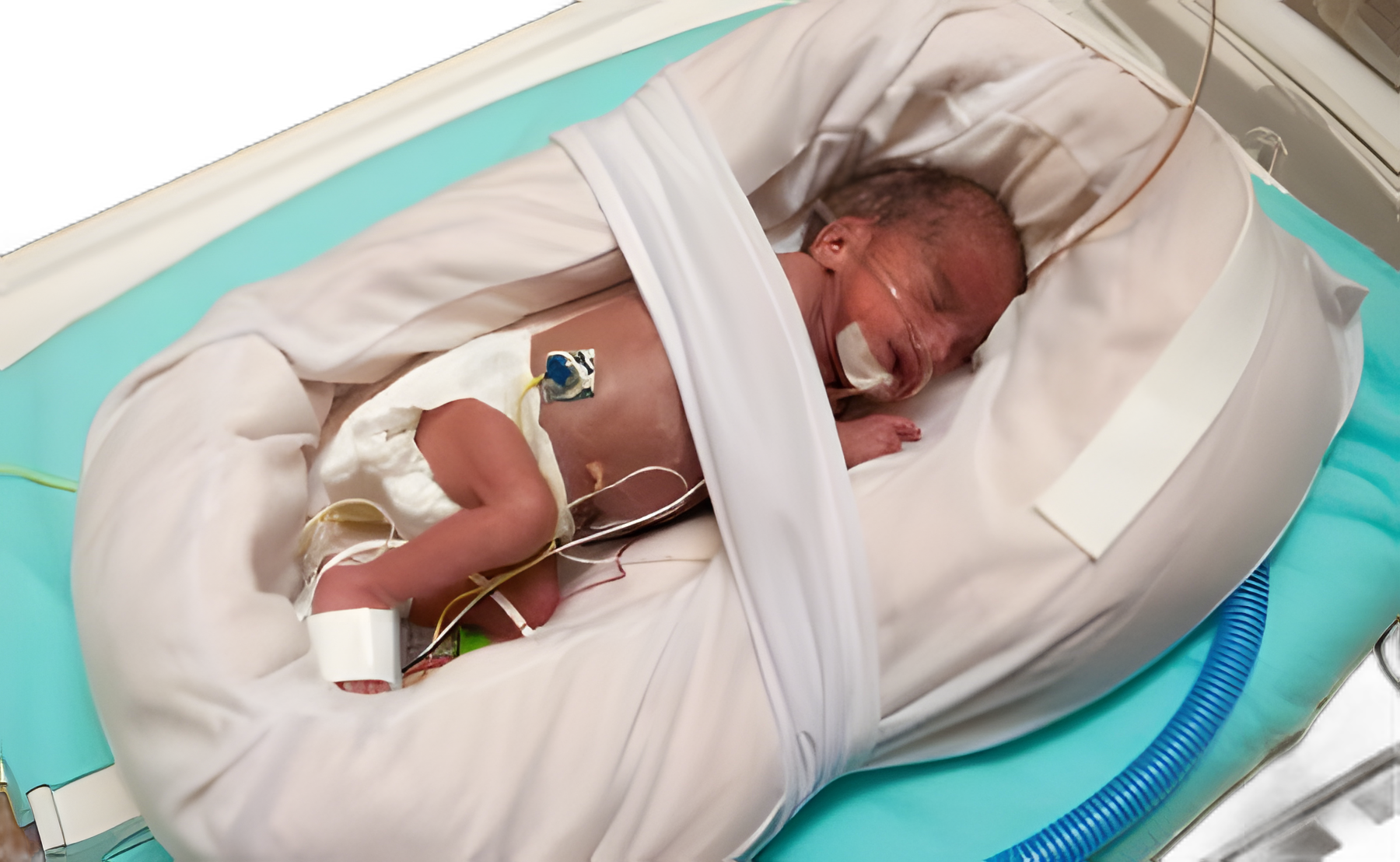 Mölnlycke Z-Flo Pediatric Fluidized Positioner 16x24 Inch - Floam Technology