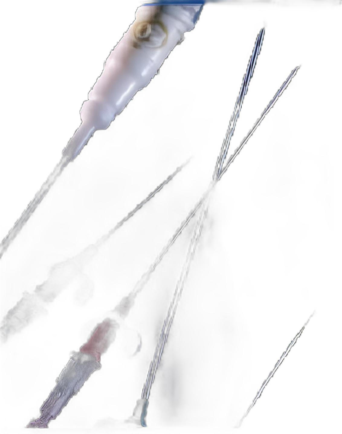 Radial Artery Catheter Kit 20 Gauge