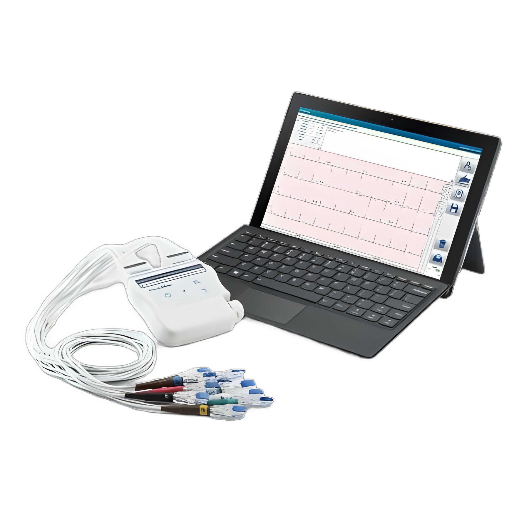 Connex® Software Package for ECG Machines by Welch Allyn - CC-RXX-WAXX