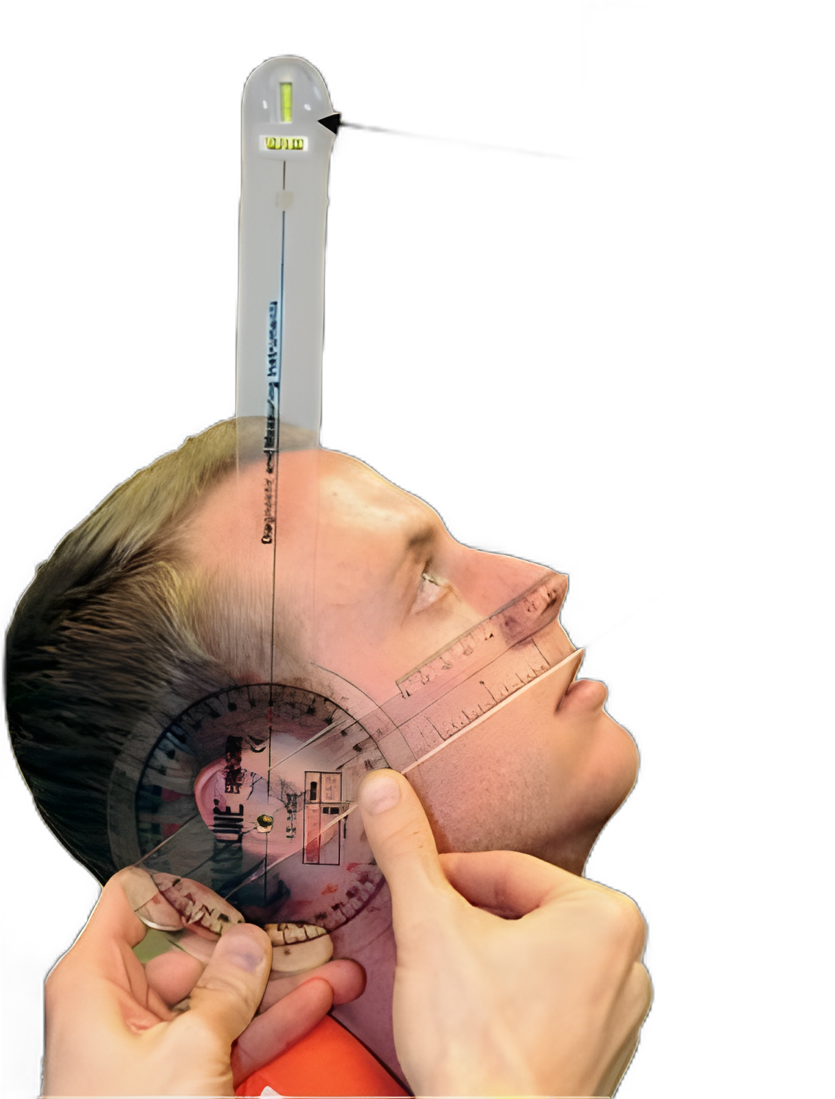 Baseline® Absolute+Axis® Goniometer