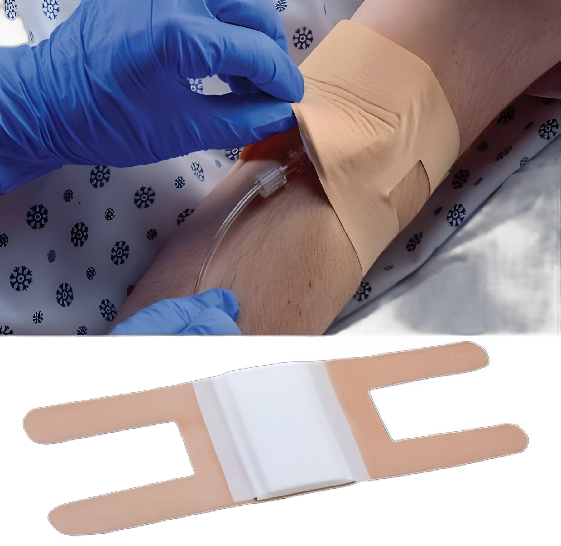 IV-ARMOR® I.V. Dressing for Secure Catheter Placement