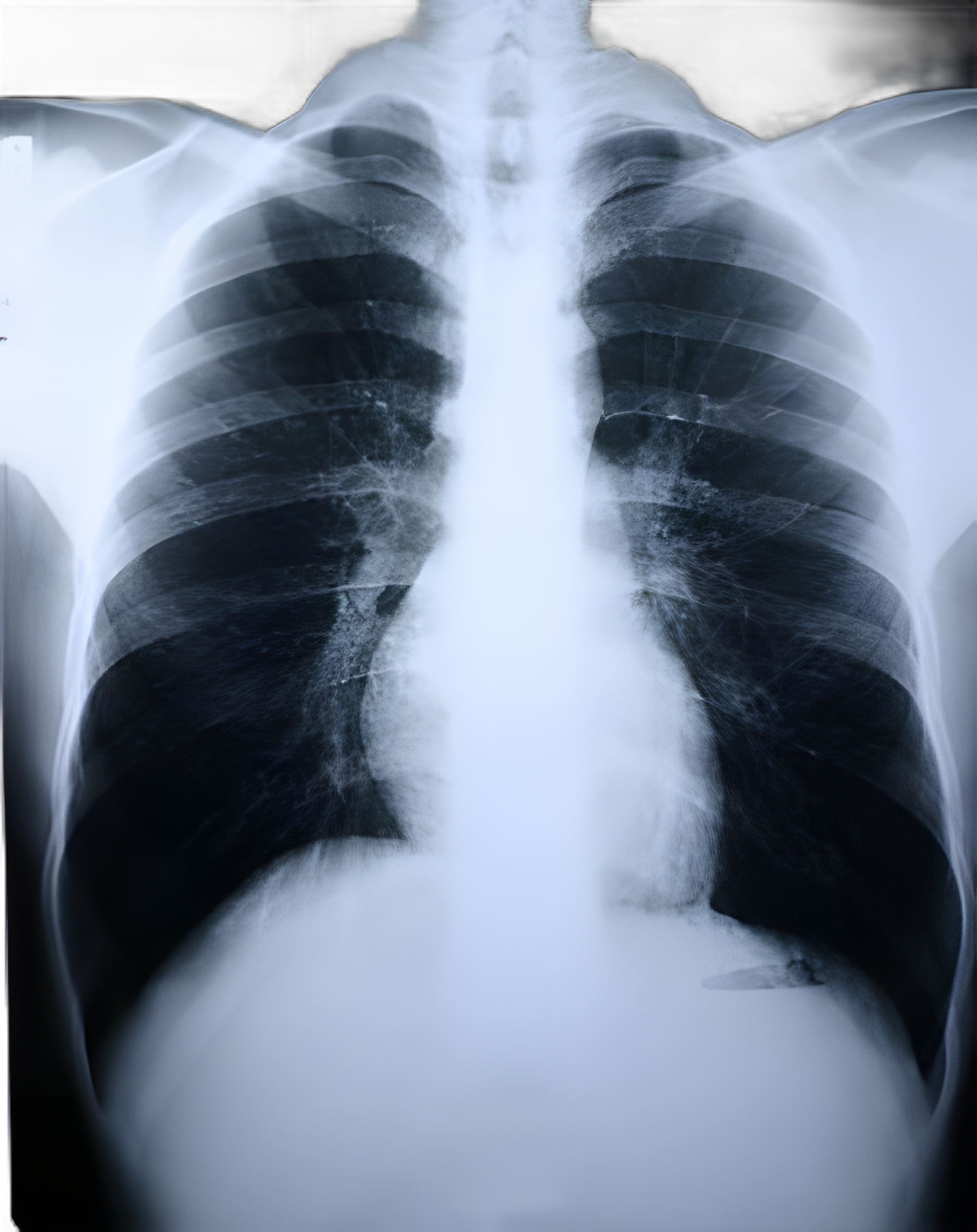 X-Ray Film Clear Choice™ Performance 14 X 17 Inch Half Speed Blue Sensitive High