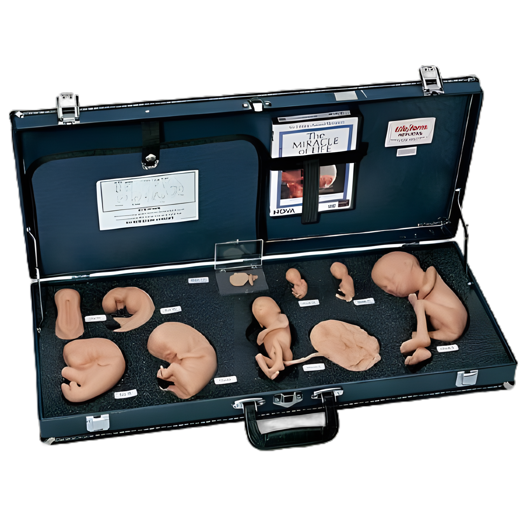 Human Reproduction and Development Kit with DVD Life/form® Plastic