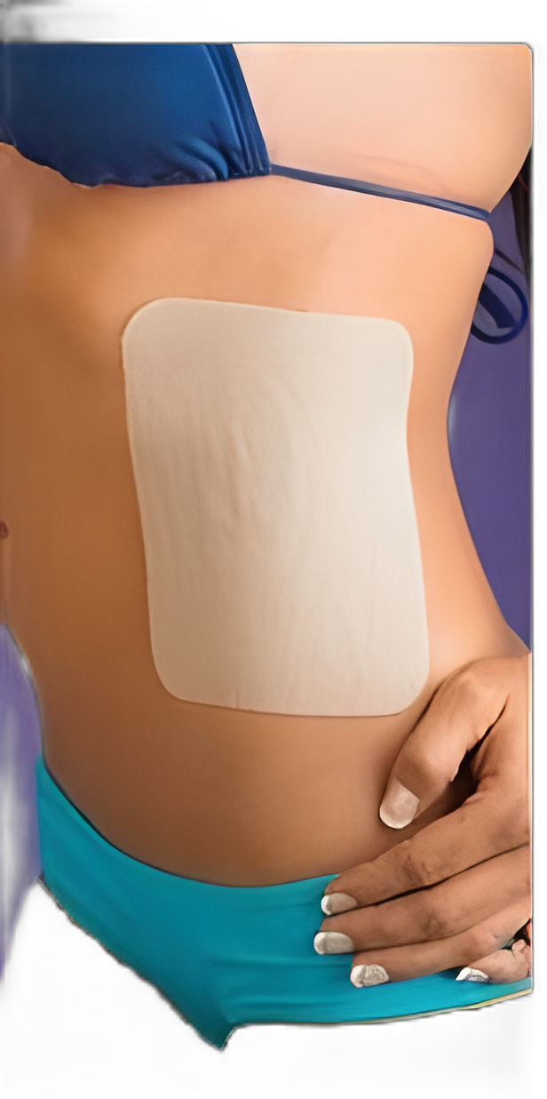 Silicone Sheeting Epi-derm® 11 X 15-3/4 Inch Rectangle NonSterile