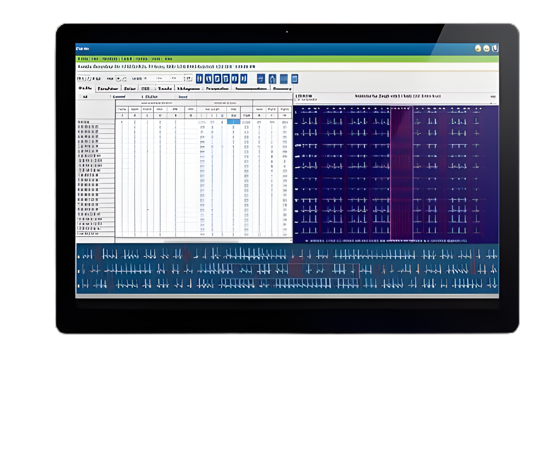 Holter Analysis System HScribe™ Digital Display