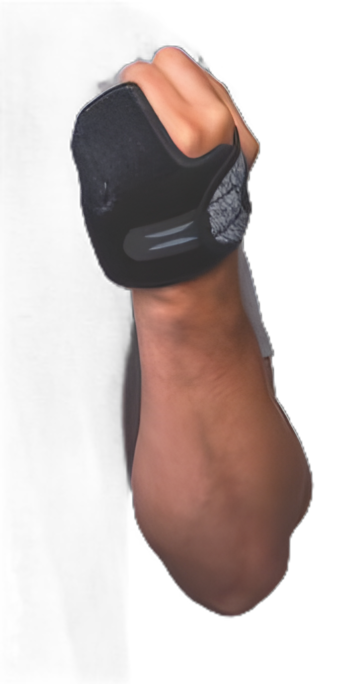 Handcuff I-Plus Orthosis for Right Hand - Large/X-Large, Low Profile Design with Foam, Nylon, Spandex, and Stainless Steel Mesh