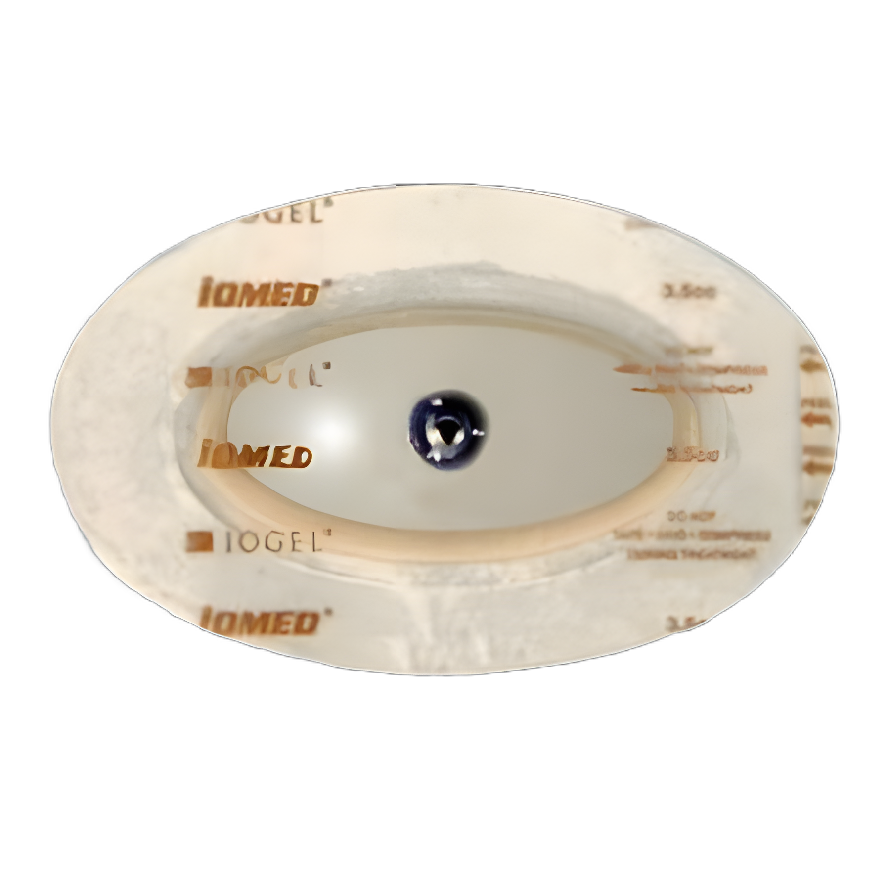 Iontophoresis Electrode Kit IOGEL® 1.5 mL Fill Volume 12/Pk