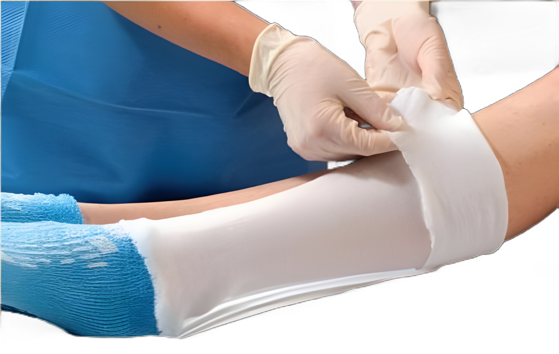 Albahealth® Cotton Stockinette Tubular 5 Inch X 25 Yard NonSterile for Medical Use