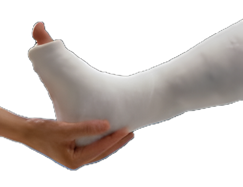 Plaster Bandage Gypsona® HP 6 Inch X 15 Foot Plaster of Paris White
