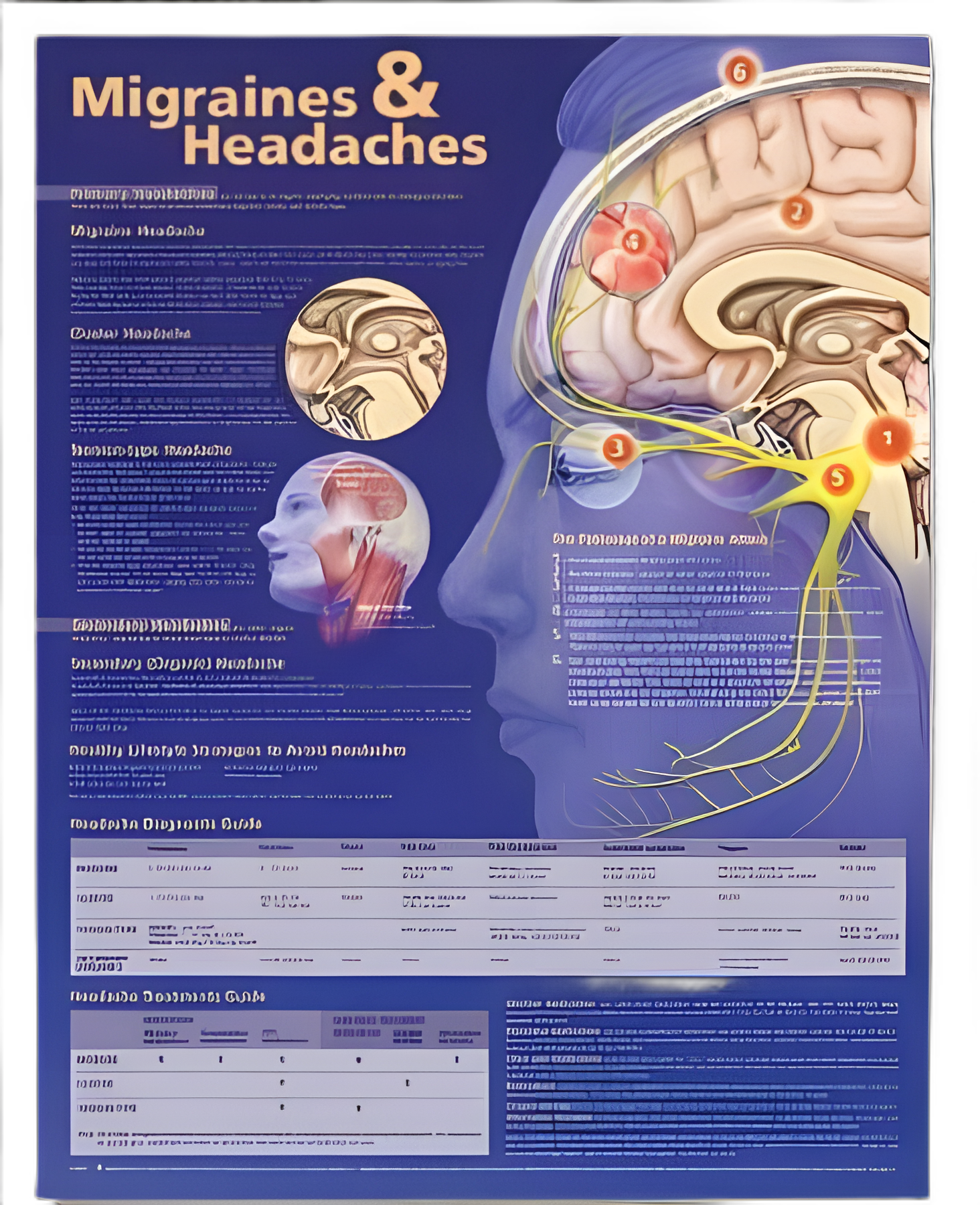 Anatomical Chart Migraines & Headaches 20 X 26 Inch Heavy Paper Grommets Laminated