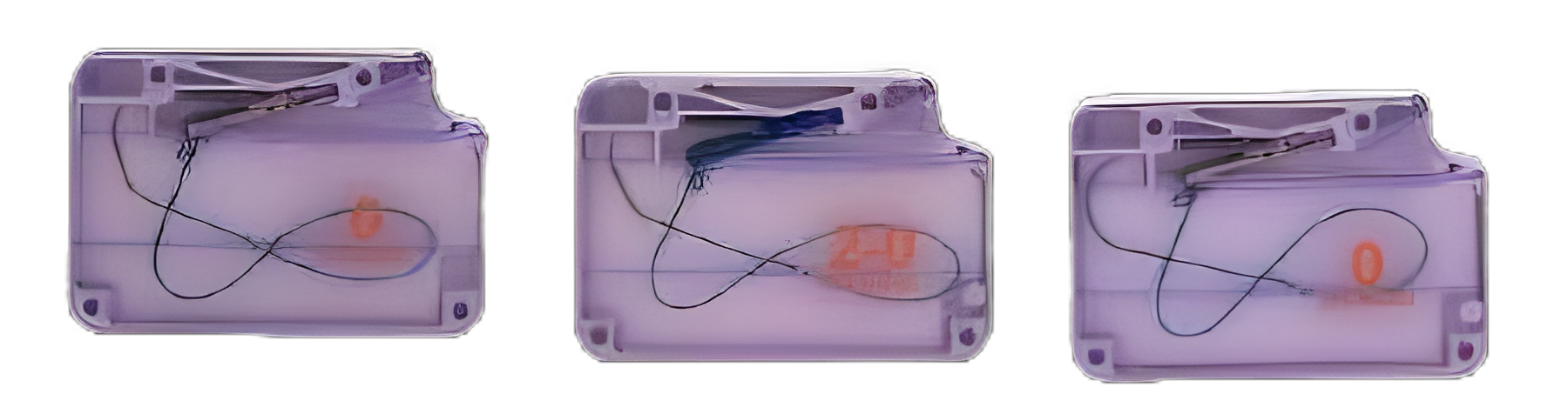 Nonabsorbable Suture Loading Unit Suture Assistant with Ethibond™ Excel Polyester EEN (Canoe) Needle Size 2-0