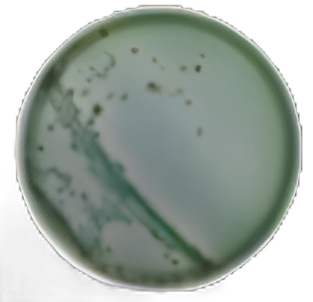 Remel TCBS Agar Plate for Vibrio Isolation - Thiosulfate, Citrate, Bile, Sucrose