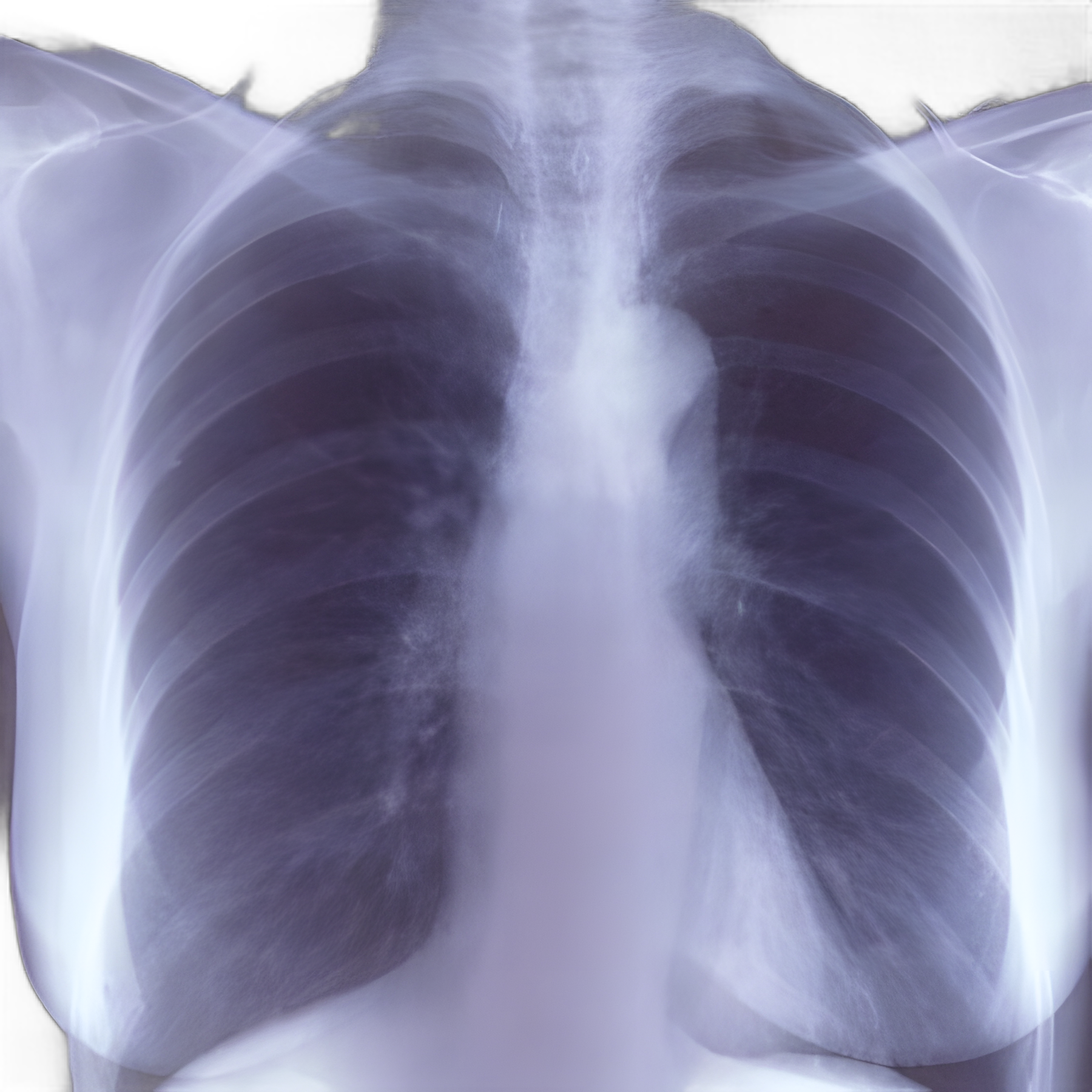 X-Ray Film Clear Choice™ Performance 9.5 X 11.75 Inch High Speed Blue Sensitive High