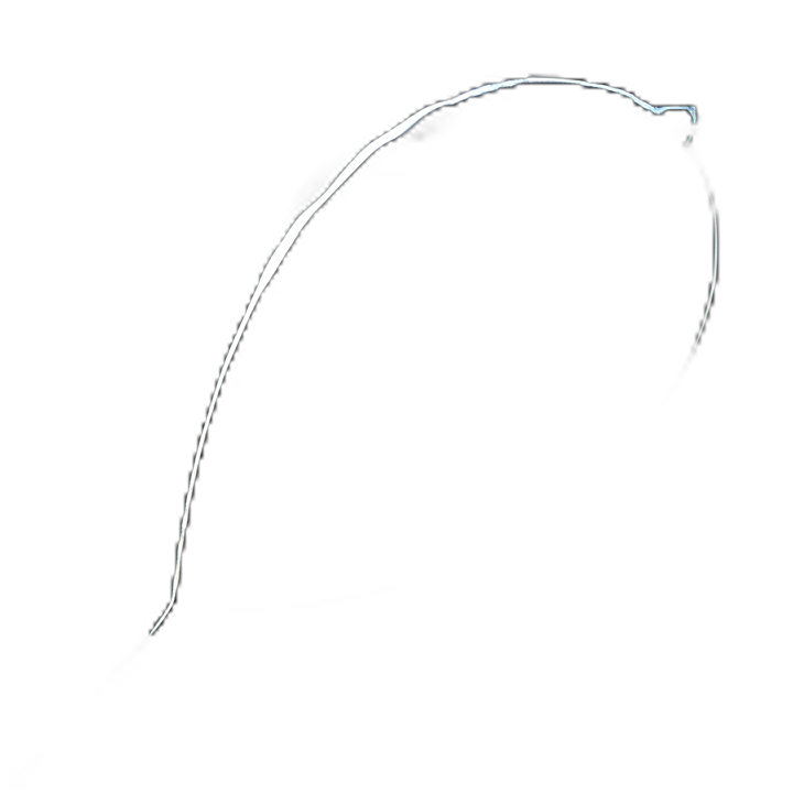 SnareMaster Oval Loop Polypectomy Snare 2300 mm - SD-240U-25 by Olympus