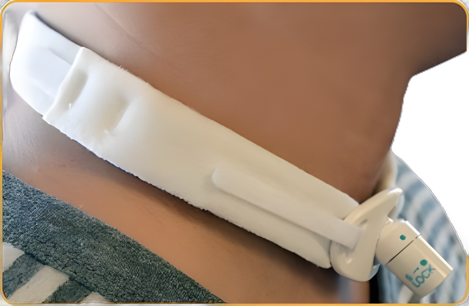 Tracheostomy Tube Collar - 220SD