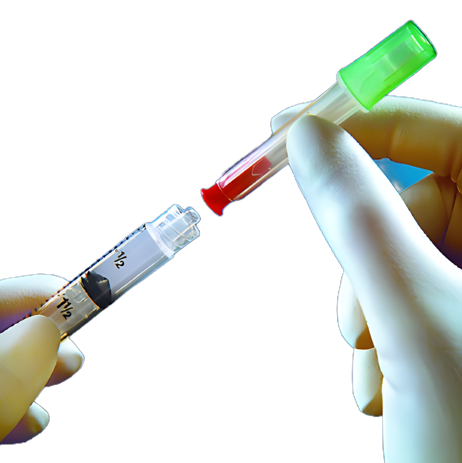 Dual Cannula with Syringe TwinPak™ Vial Access Pin / Blunt Tip Cannula 3 mL 20 Gauge Pin / 17 Gauge Cannula