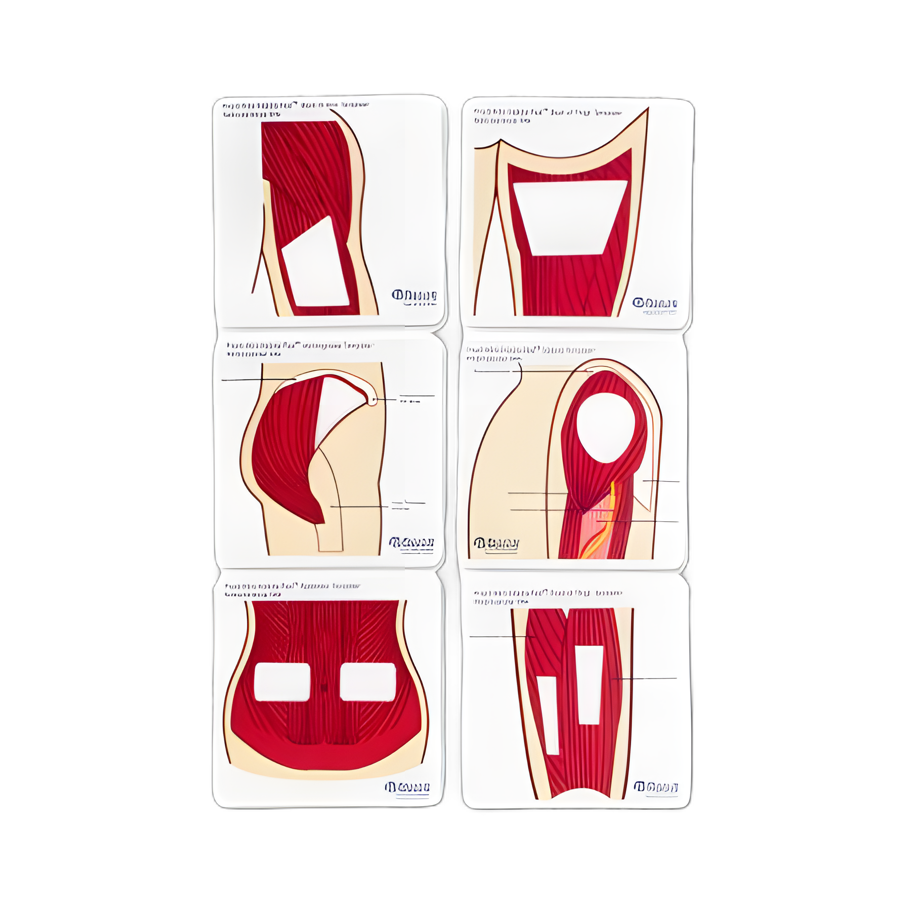 Practi-Mini Anatomical Templates for Injection Training - 5x5 Inch