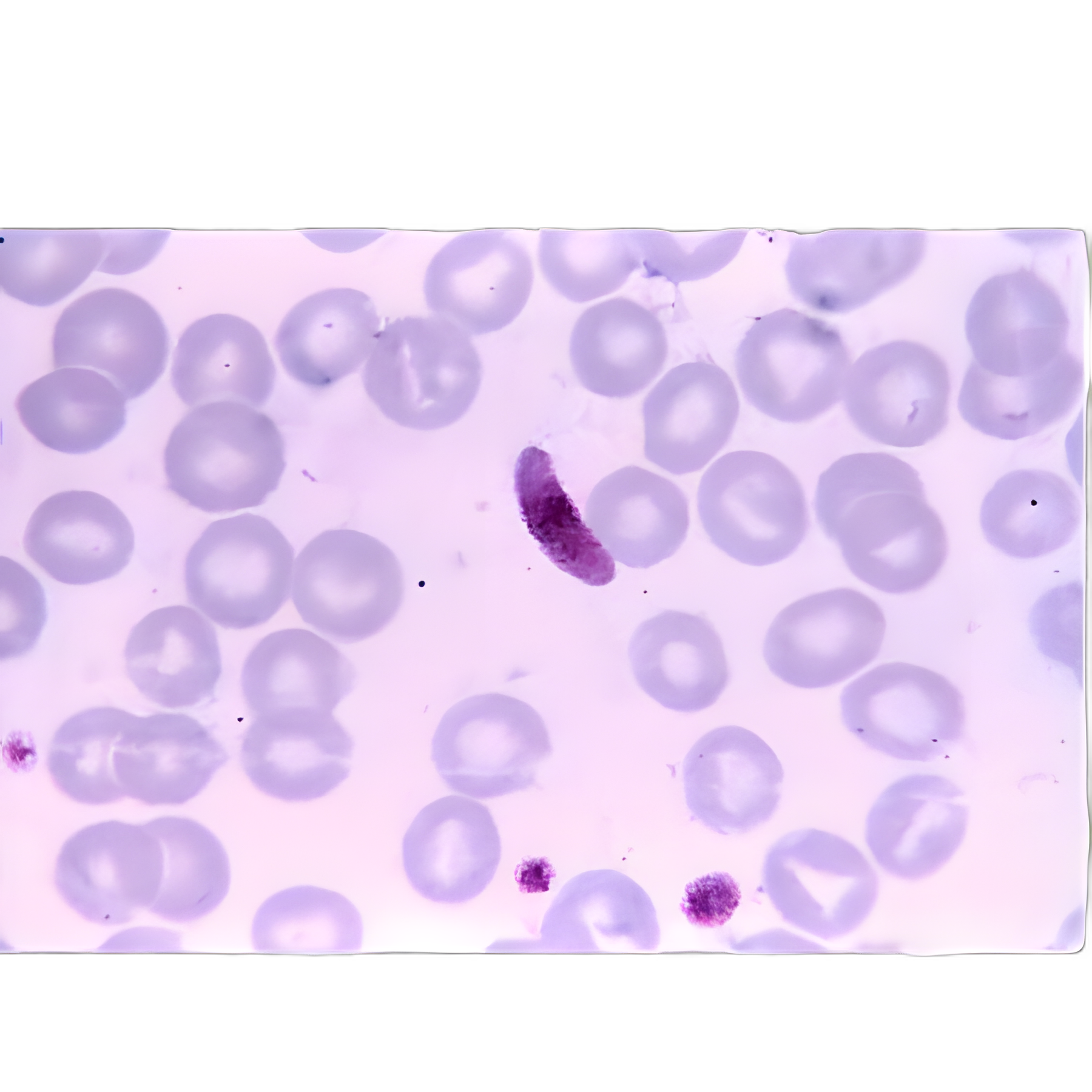 Parasitology Stained Slide Set 1x3 Inch for Educational Use - Scientific Device Lab