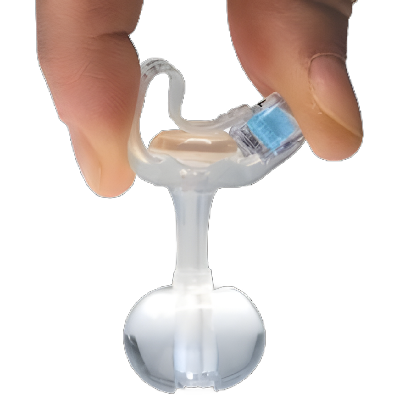 MiniONE® 14 Fr. Low Profile Balloon Button Gastrostomy Tube Kit - Silicone Sterile