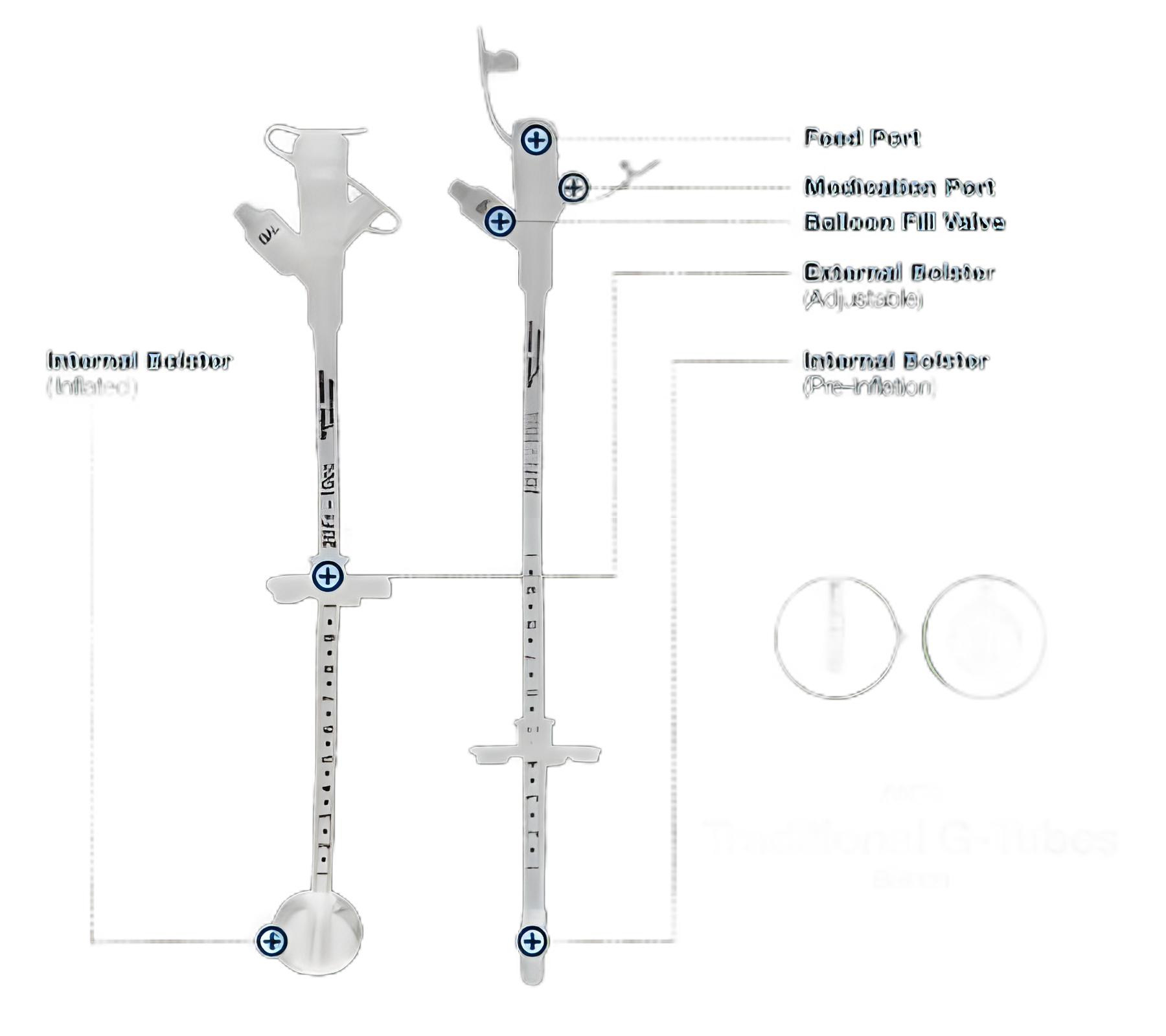 AMT 14 Fr. Y-Port Balloon Gastrostomy Tube Kit - Silicone, Sterile