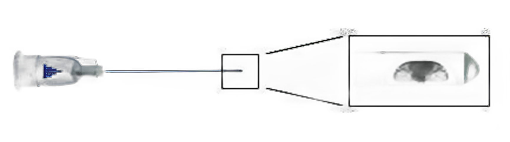 Aesthetic Microcannula SteriGlide® Flexible 1 Inch Length 30 Gauge Regular Wall Without Safety