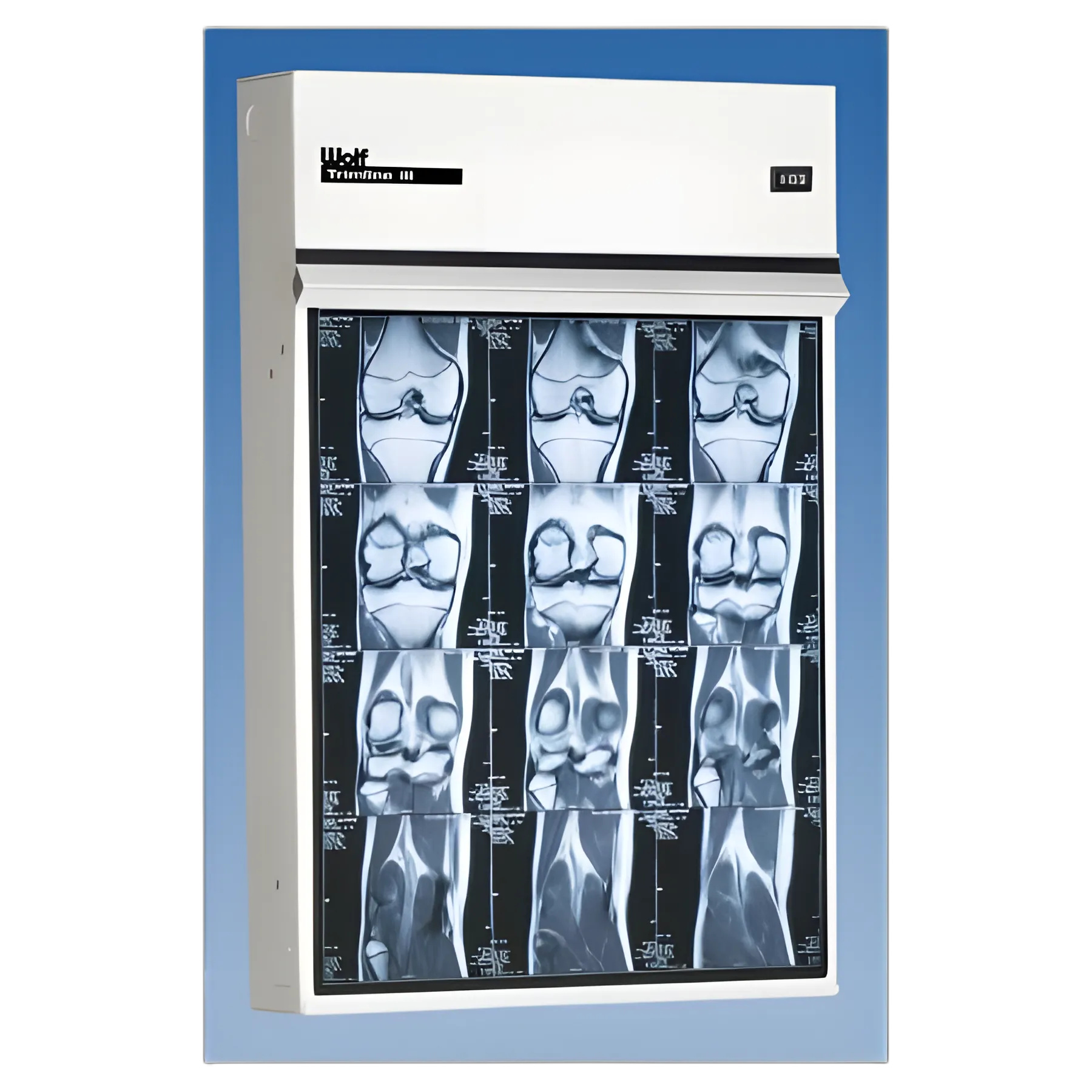 X-Ray Illuminator Trimline III 3 Bank 1 Tier 3 Lamp 15 W Mobile Stand 42 W X 22 H X 3-1/4 D Inch Three, 17 L X 14 W Inch Film