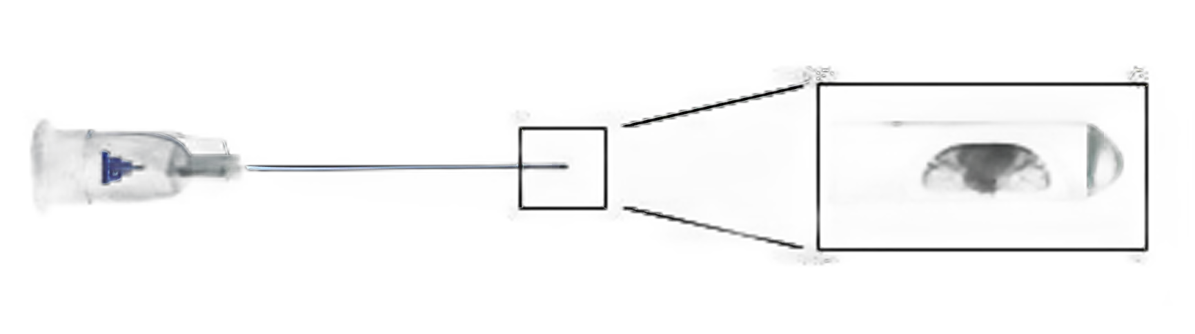 SteriGlide® Aesthetic Microcannula 50mm - High Precision, Latex-Free