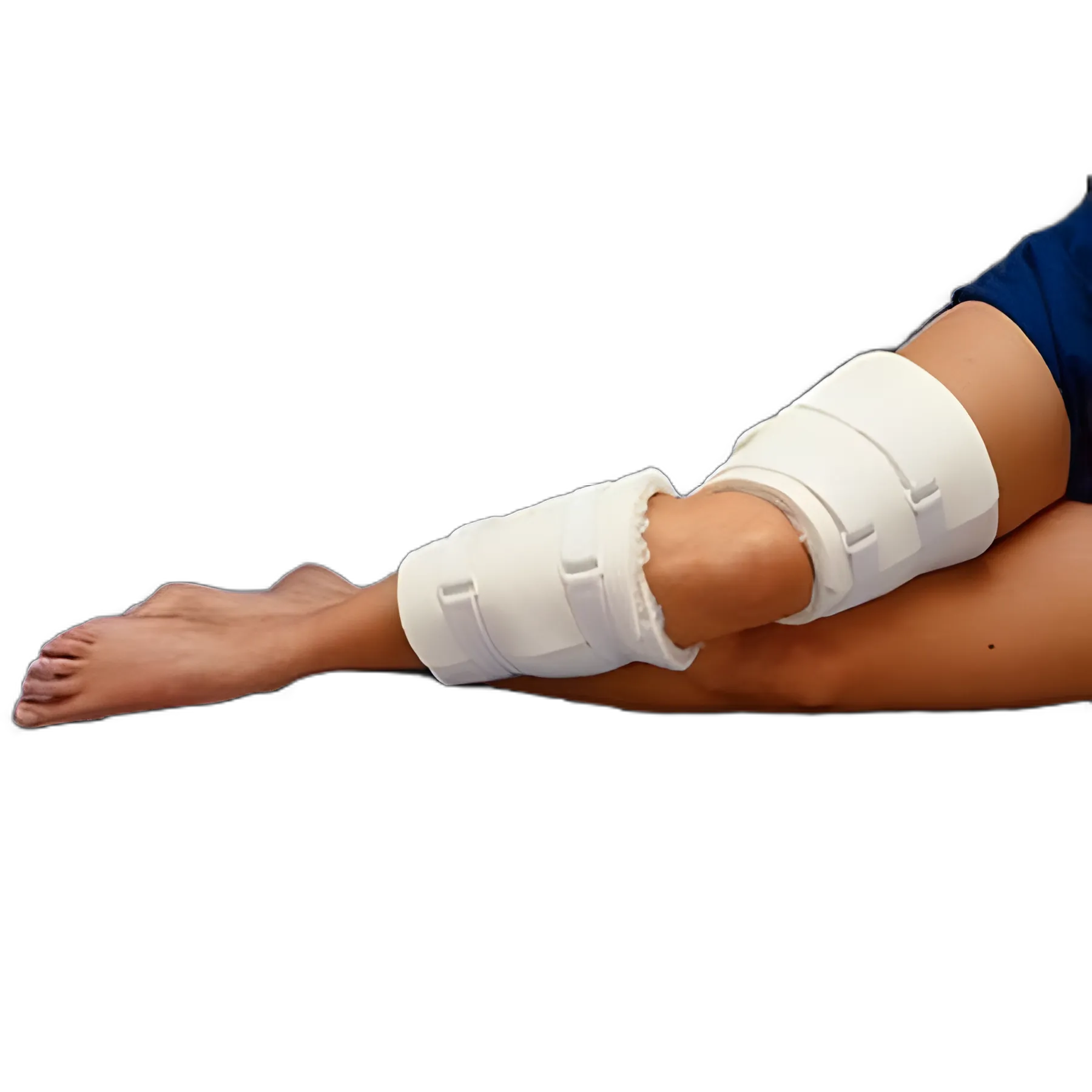 Elbow / Knee Splint Rolyan® Progressive™ Medium Thermoplastic Stay 5.375 Inch L Proximal Cuff, 15-1/4 to 17-1/2 Inch Limb Circumference