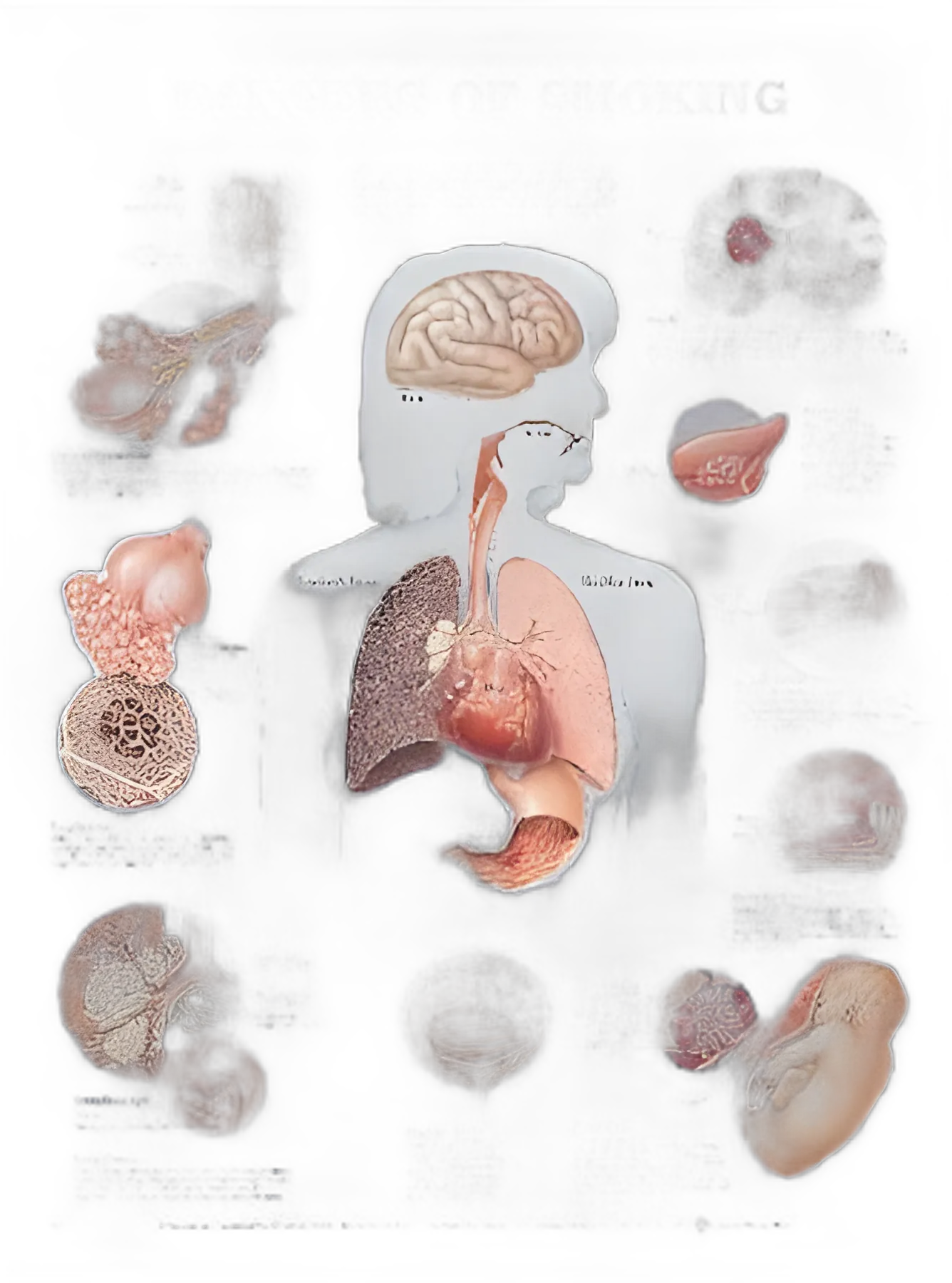 Anatomical Chart Dangers of Smoking 20 X 26 Inch Plastic Wall Mount Laminated