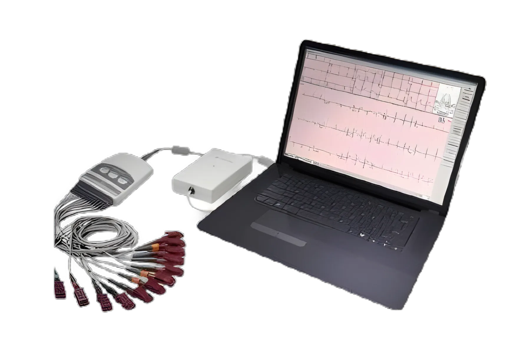 GE CardioSoft Electrocardiograph AC/Battery Operated - Digital Resting EKG System