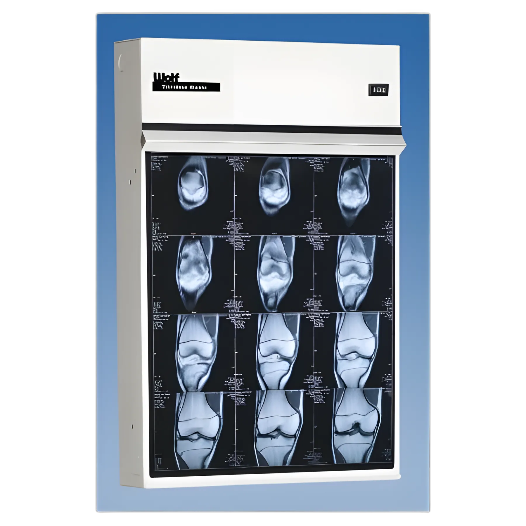 X-Ray Illuminator Trimline Basic 2 Bank 2 Tier 2 Lamp Wall Mount 44 W X 14 H X 3-1/4 D Inch Two, 17 L X 14 W Inch Film