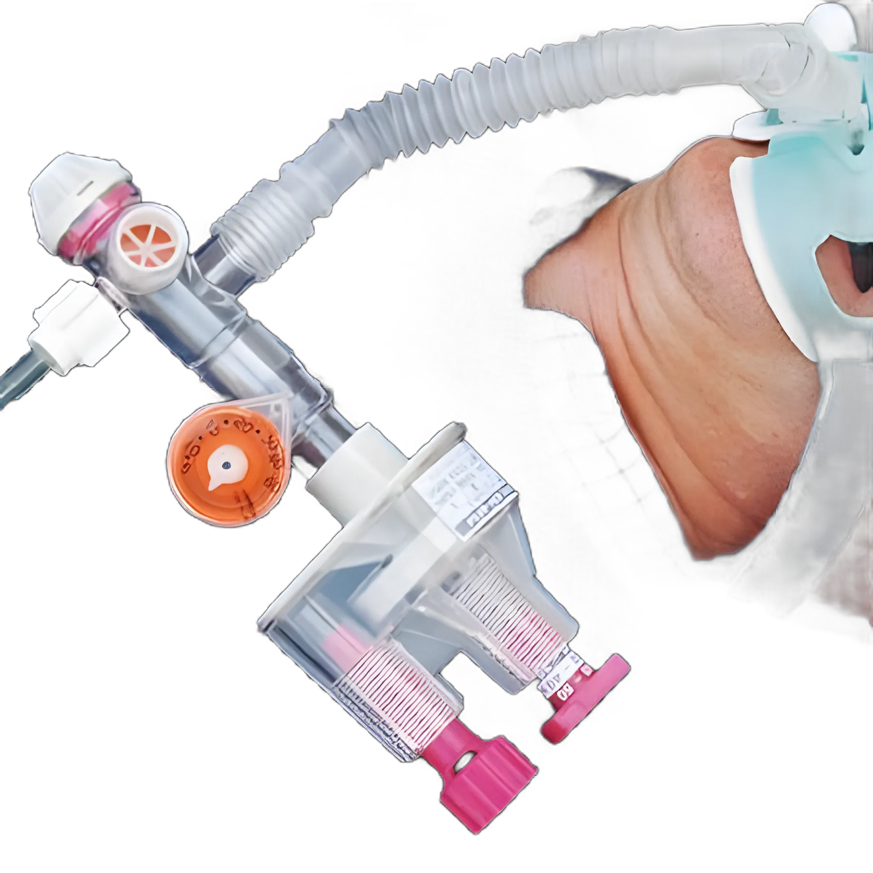 Surevent™ Transport Ventilator Automatic - Emergency Pre-Hospital Respiratory Support