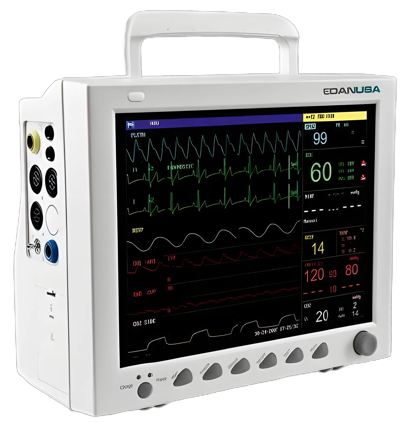 Edan iM8 Vital Signs Monitor: ECG, NIBP, SpO2, Respiratory, Temperature Monitoring