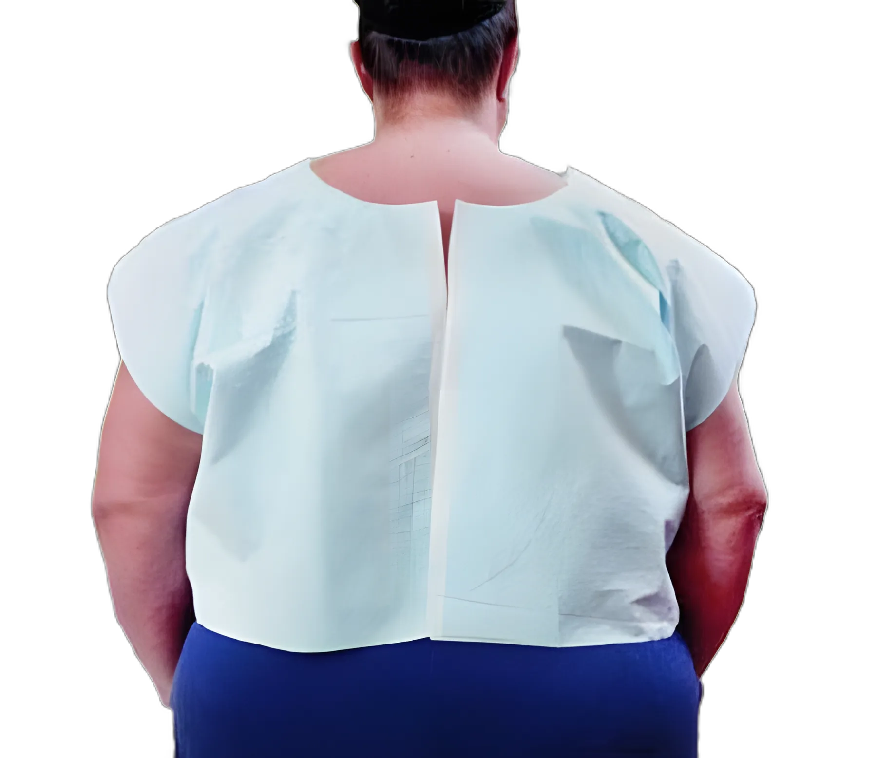 Exam Cape Tidi® Blue X-Large Front / Back Opening Without Closure Unisex