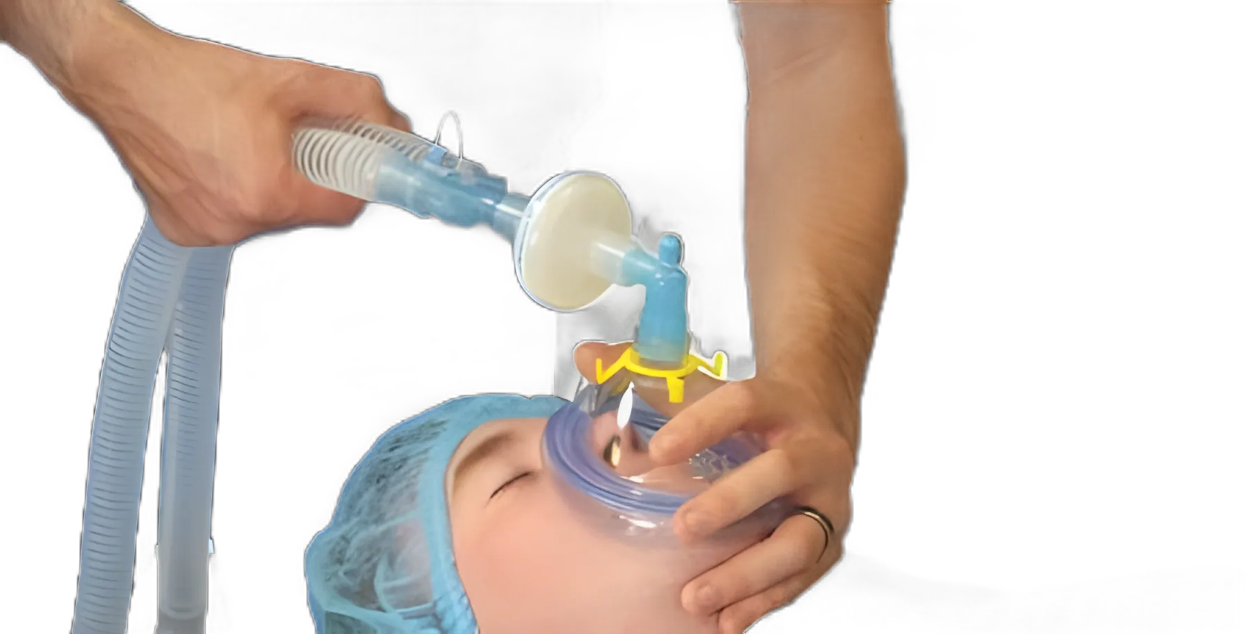 Flexicare® Anesthesia Breathing Circuit Expandable Tube 96 Inch Tube Dual Limb Adult 3 Liter Bag Single Patient Use - 038-01-614U