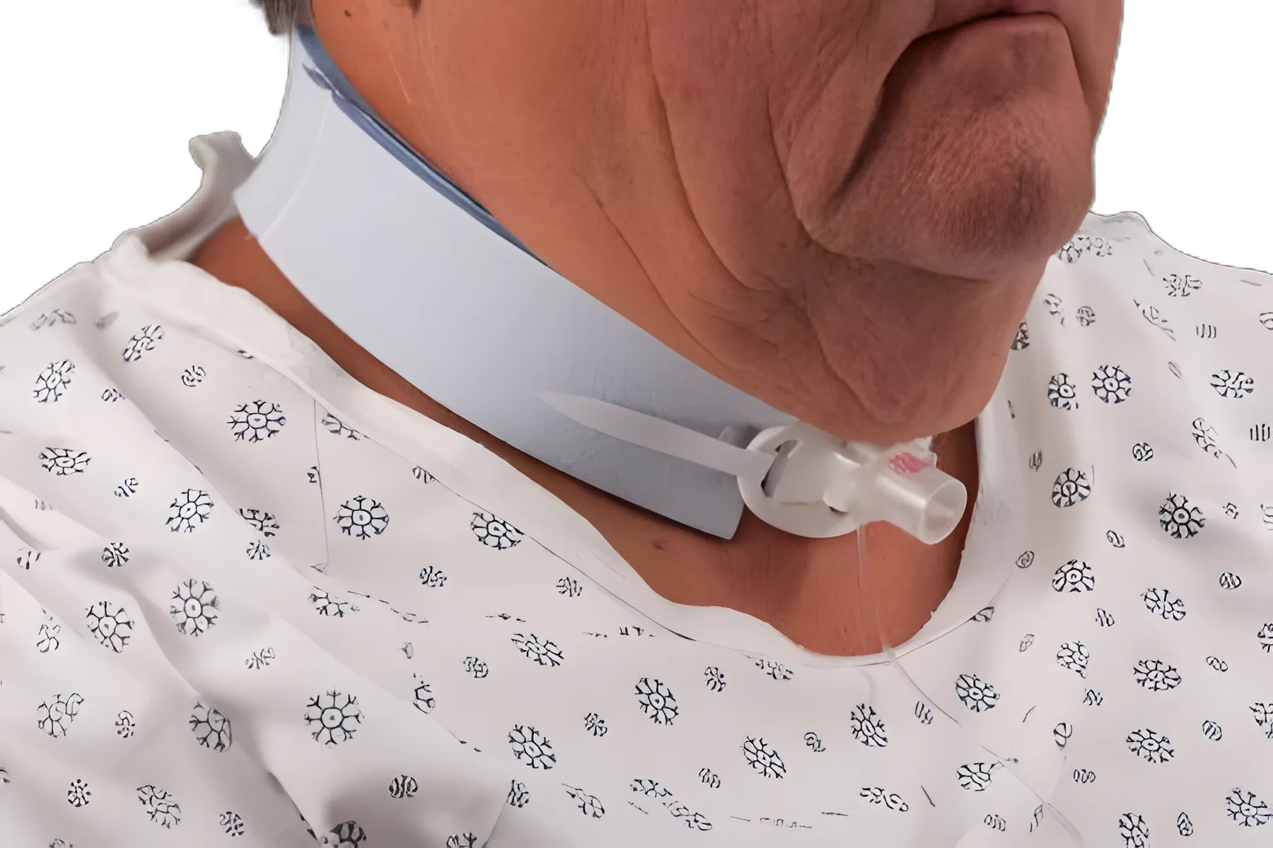 Tracheostomy Tube Holder Dale® Blue® 1-1/2 W X 28 Inch