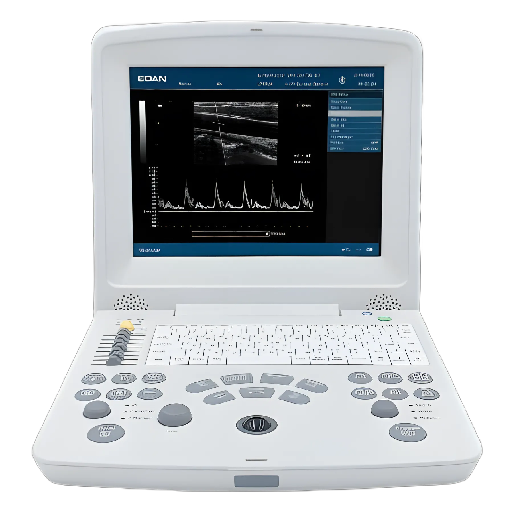EdanUSA DUS 60 Ultrasound System with Advanced Imaging Capabilities