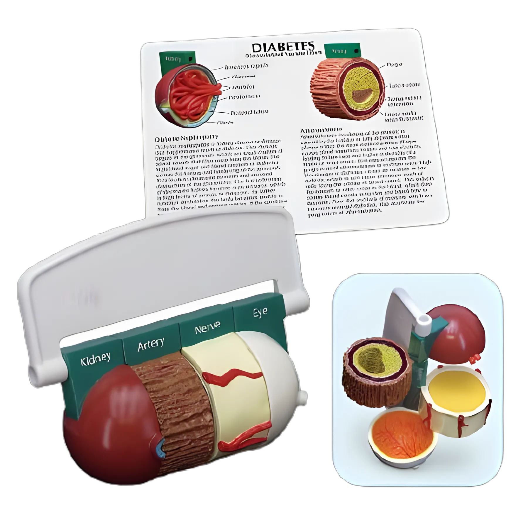 Diabetes Educational Model by Nasco Healthcare