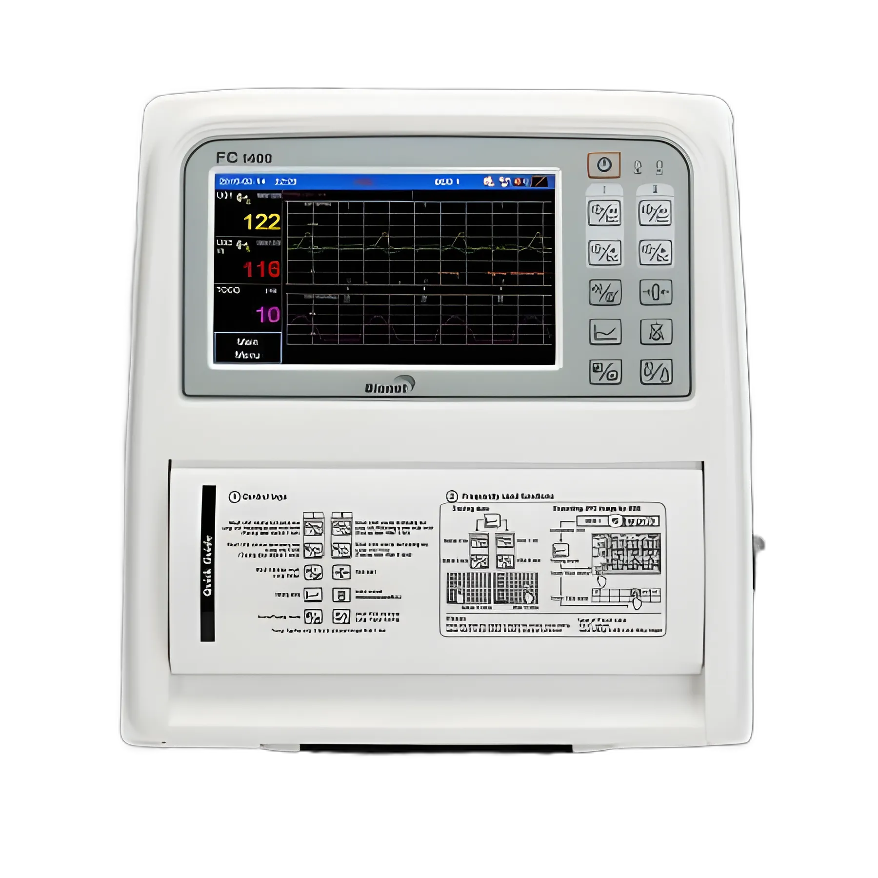 Advanced Fetal Monitor with 7 Inch TFT LCD Screen and USB Storage by Bionet America