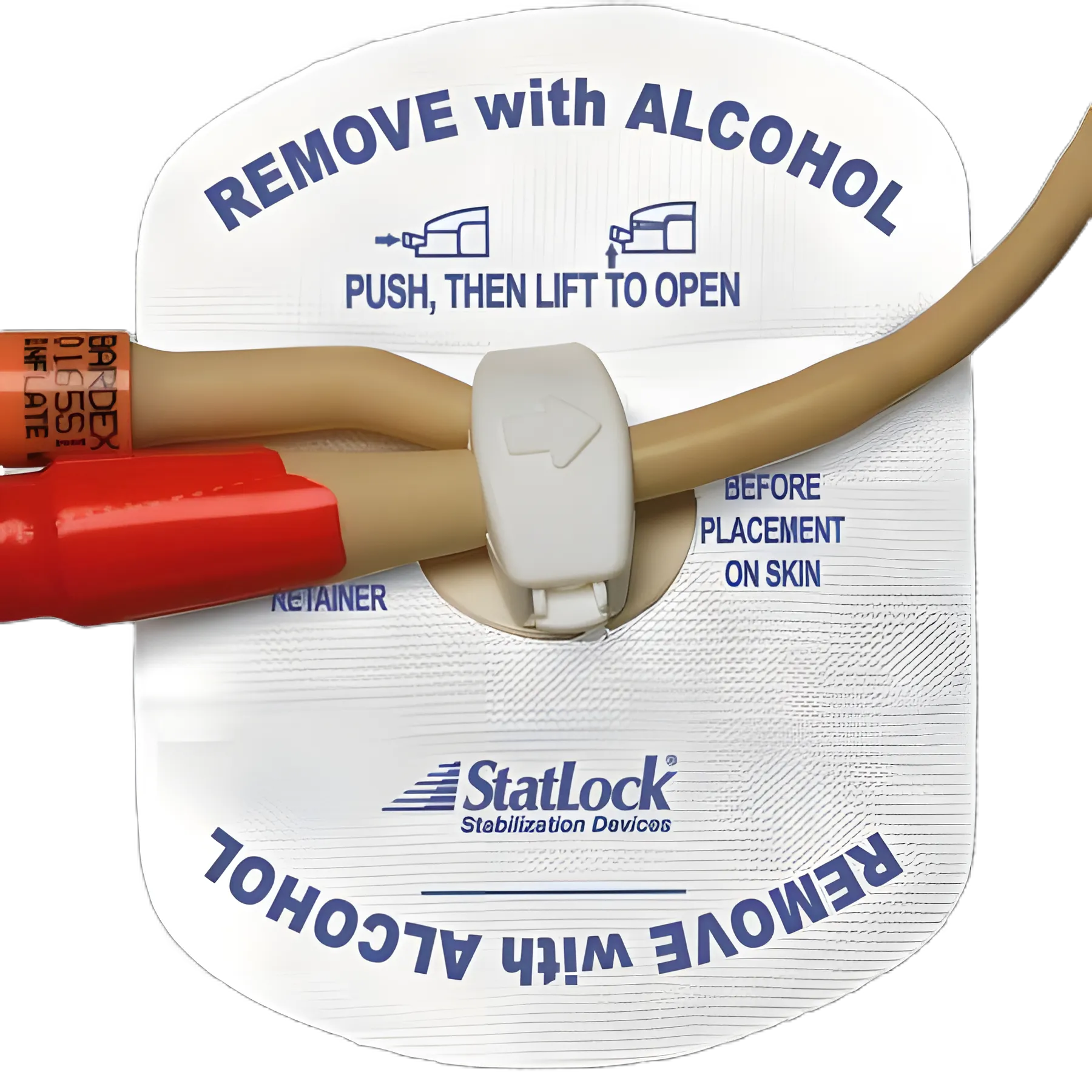 Foley Stabilization Device Statlock® Sterile, Tricot Anchor Pad, Adult