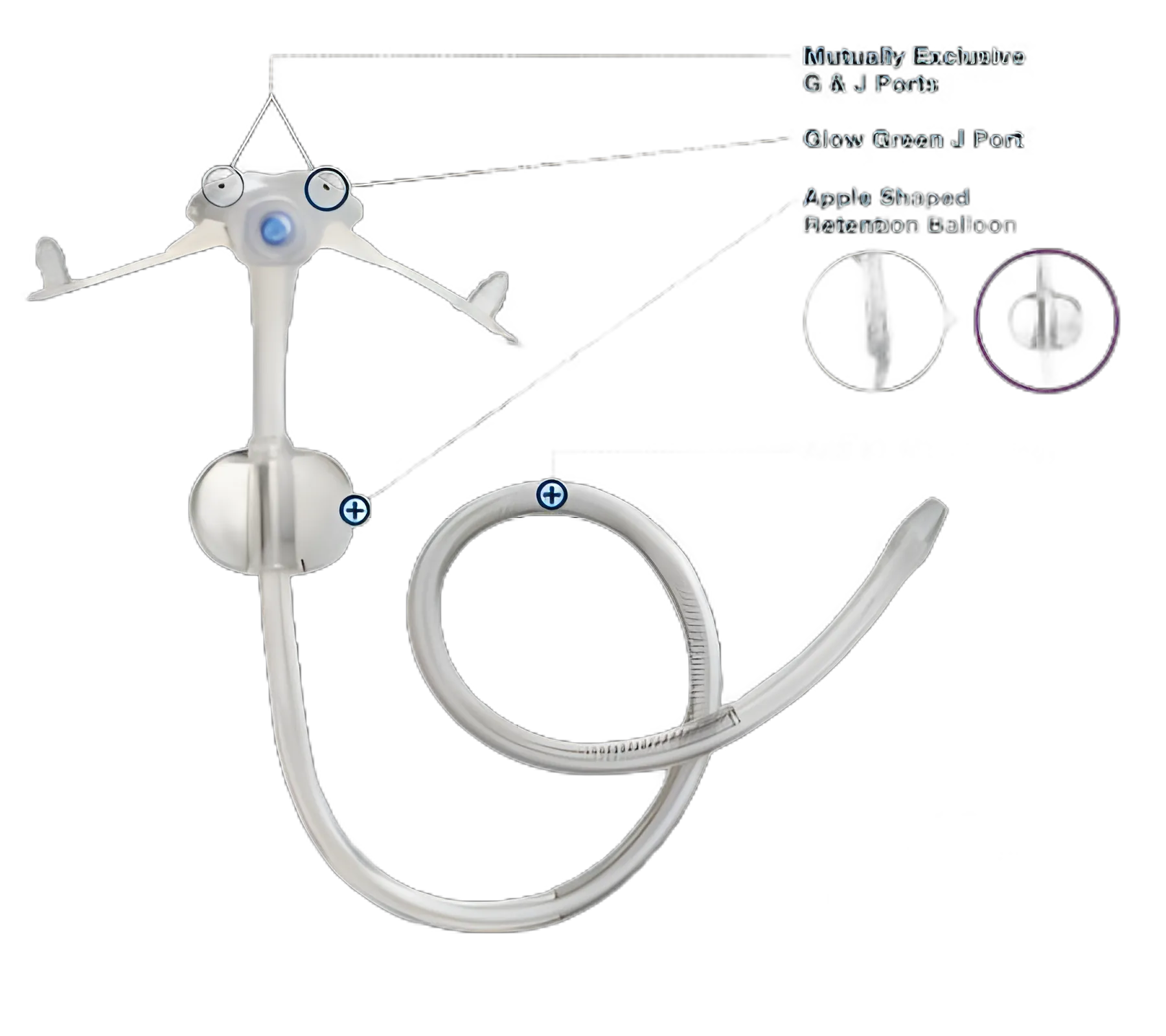 Low Profile G-JET® Button Gastrojejunostomy Tube 14Fr 30cm