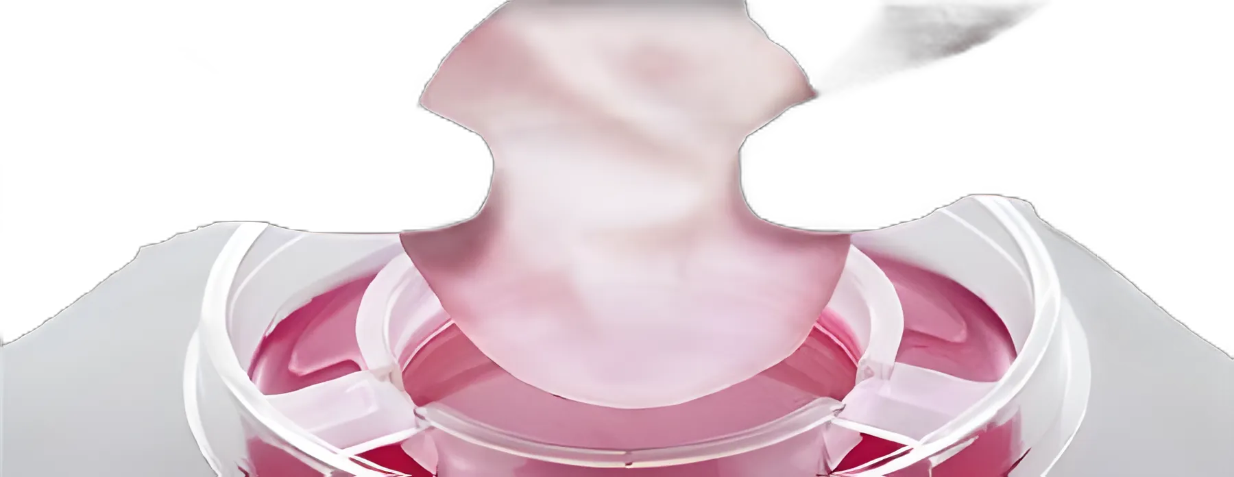 Skin Graft Therapy Apligraf® Round Viable human cells, cultured in vitro