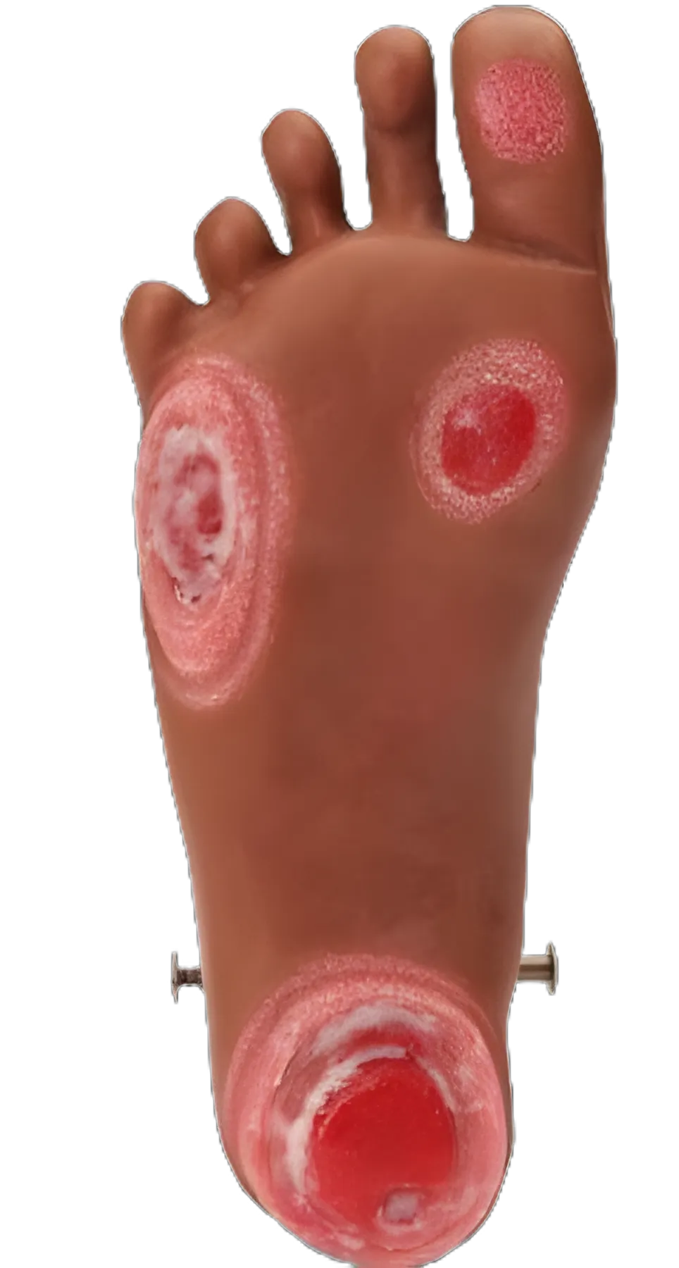 Life/form GERi and KERi Optional Pressure Injury Foot Model for Wound Care Training